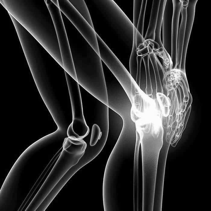 Какой врач лечит повреждения коленного сустава