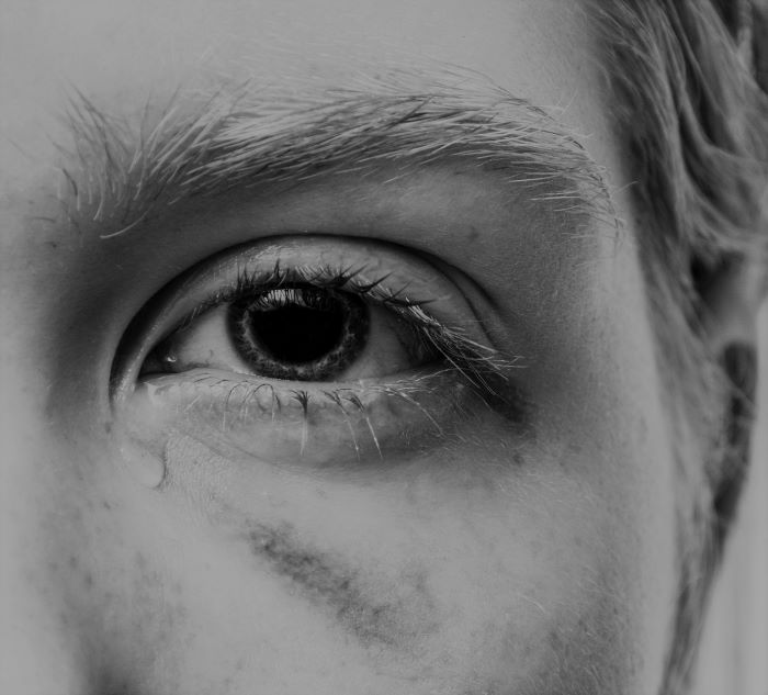 Какой врач лечит боль в глазу после травмы глаза