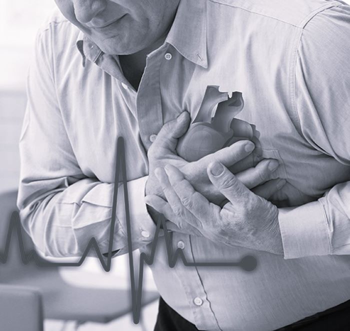 Какой врач лечит боль в сердце при мерцательной аритмии