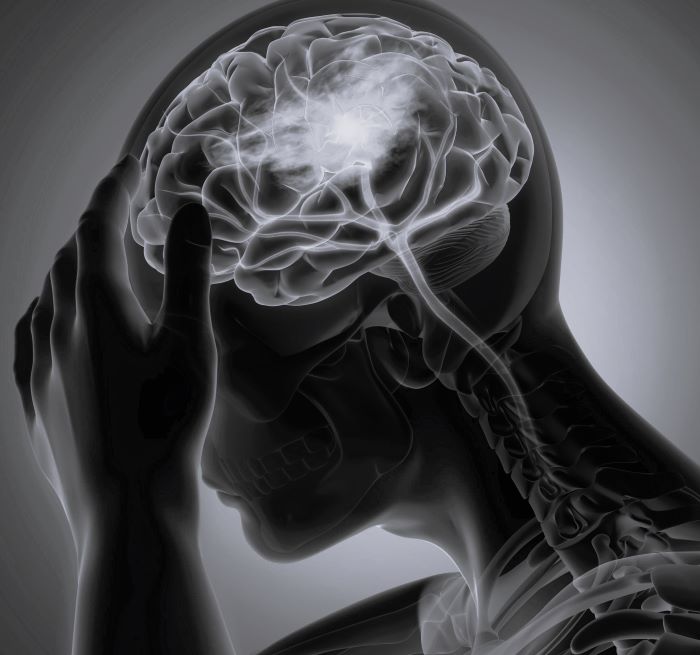 Какой врач лечит головные боли при опухоли головы