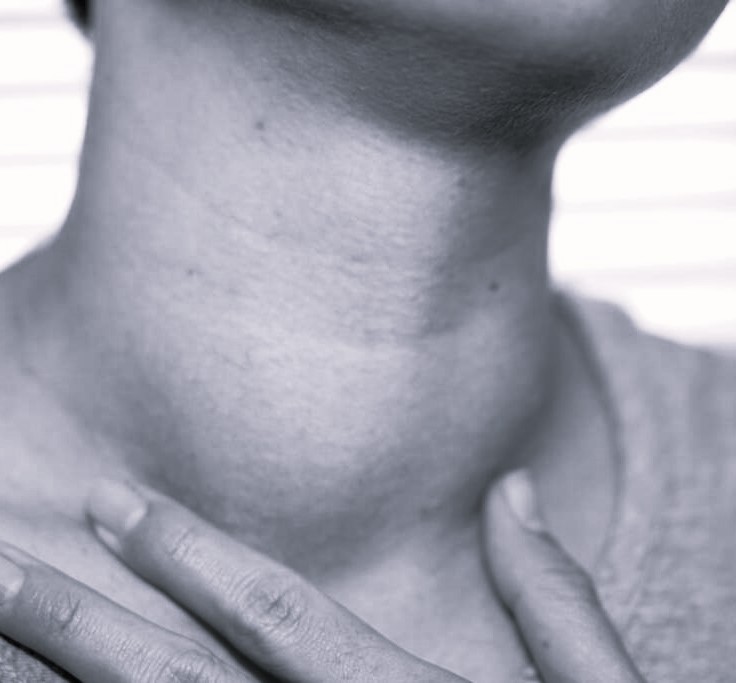 Какой врач лечит боль при увеличении щитовидной железы