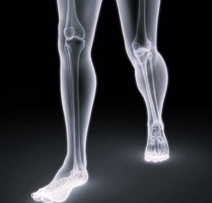 Какой врач лечит боль в костях ног при ходьбе