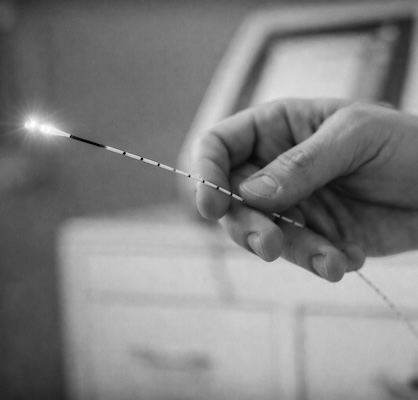 РЧА печени в Санкт-Петербурге