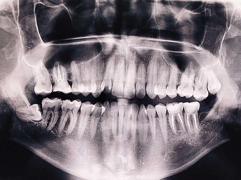 Ломит зубы: причины ноющей боли и как их устранить