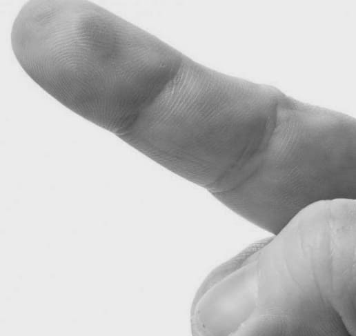 Что такое герпетический белый палец