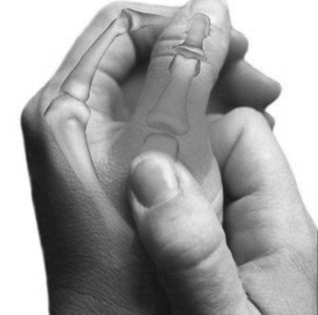 Какой врач лечит артрит большого пальца руки