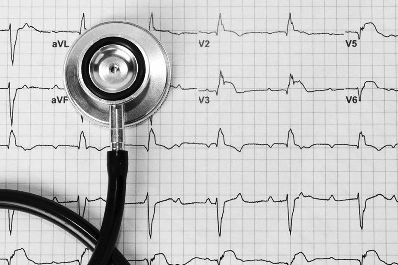 Какой врач лечит дилатационную кардиомиопатию