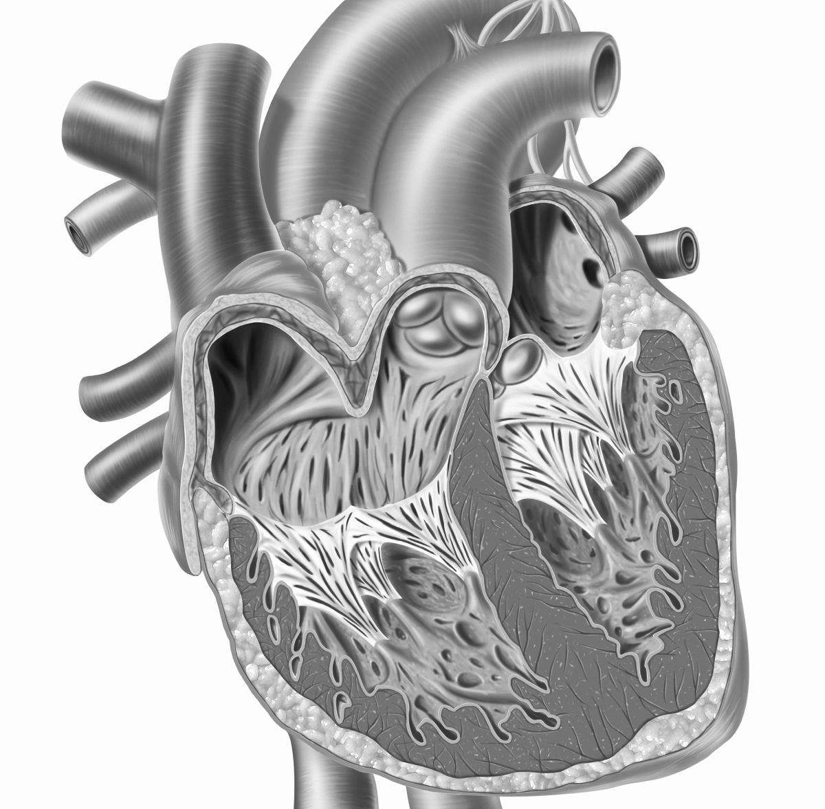Какой врач лечит фибрилляция желудочков сердца