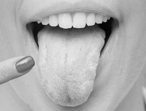 Воспаление языка - признаки, симптомы, кто лечит, кто лечит