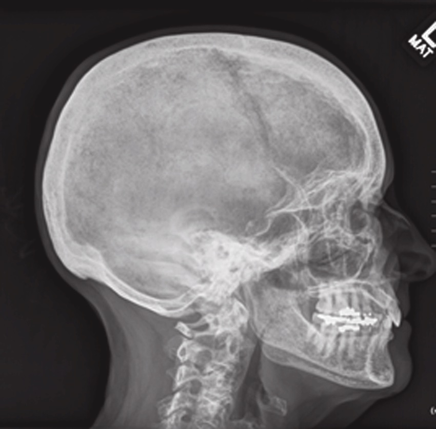 Какой врач лечит черепно-мозговую травму