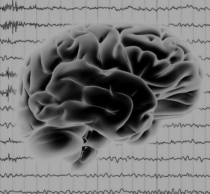 Что такое стереоэлектроэнцефалография - простыми словами