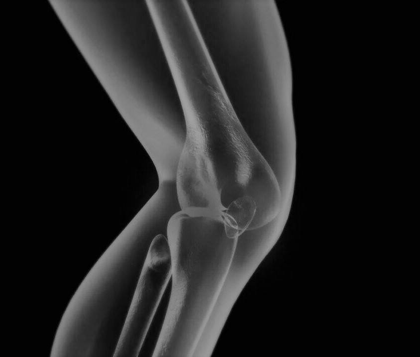 Что такое артроскопия коленного сустава - простыми словами