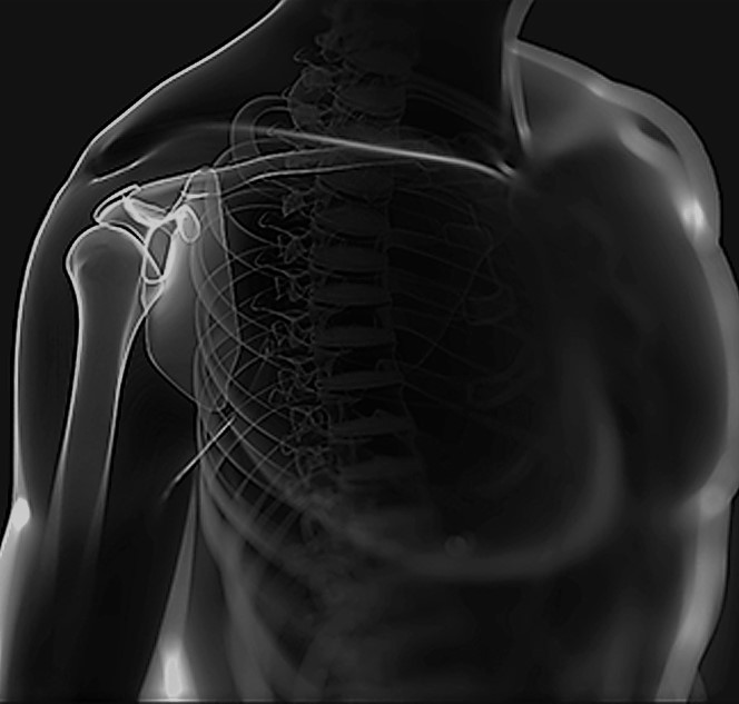 Что такое артроскопия плечевого сустава - простыми словами