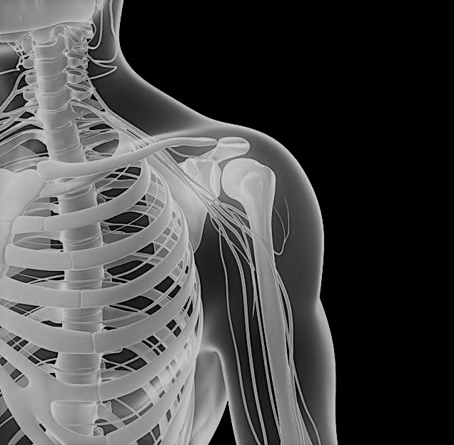 Что такое операция по замене плечевого сустава - простыми словами