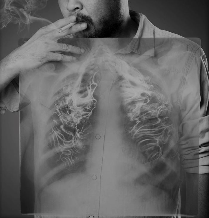 Какой врач лечит боль в груди после курения
